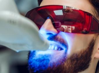 Does Laser Teeth Whitening Have Any Side Effects?