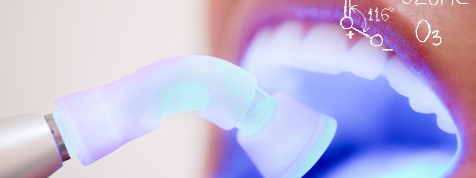 Ozone Whitening