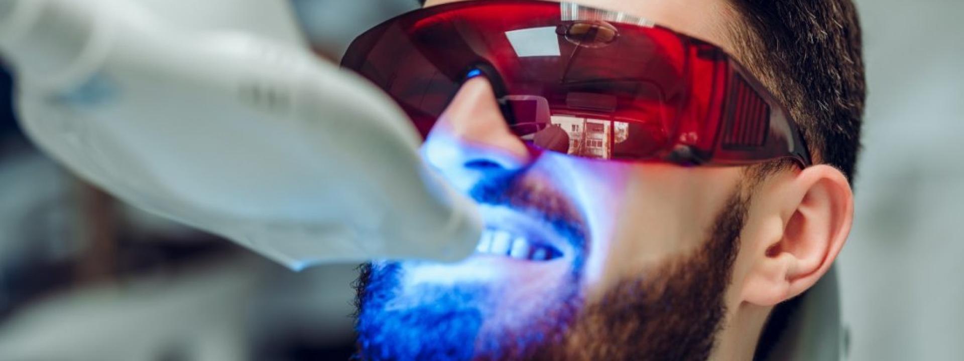 Laser Teeth Whitening